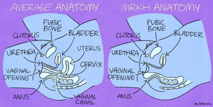 13 Reasons Why Your Vagina Might Hurt During Sex 13 Reasons Why Your Vagina Might Hurt During Sex
